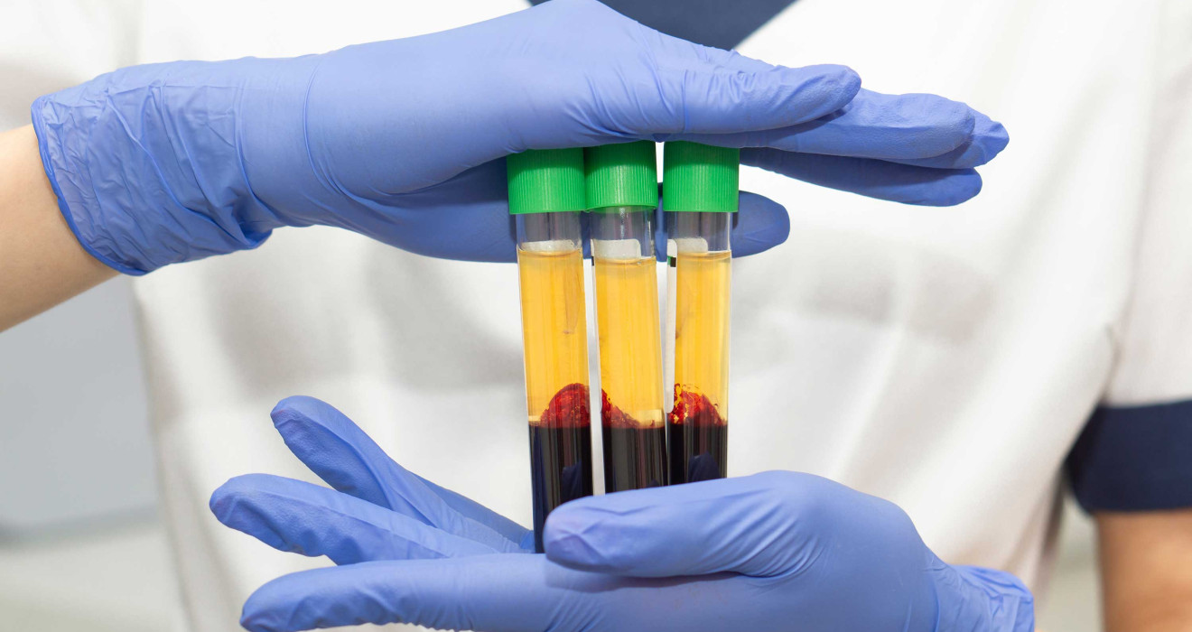 PRP-CGF Uygulamaları 